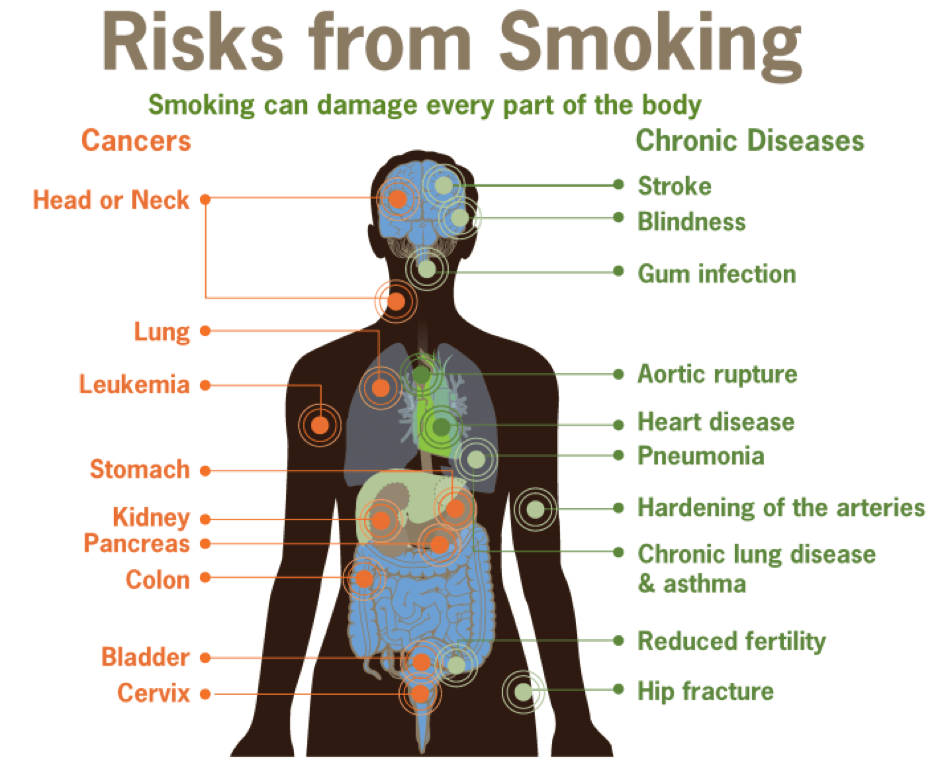 Smoking Poppers vs Cigarettes. What is Better? - Ask on JustDoc